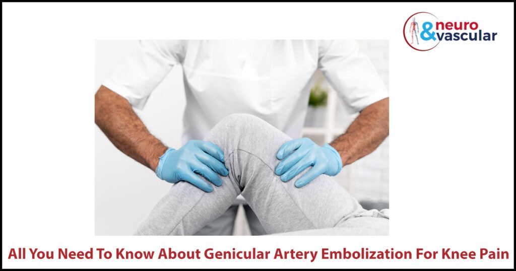 Genicular Artery Embolization Procedure