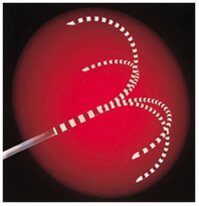 Liver Stenting Procedure in Hyderabad