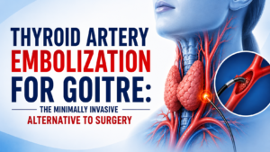 Thyroid Artery Embolization Illustration
