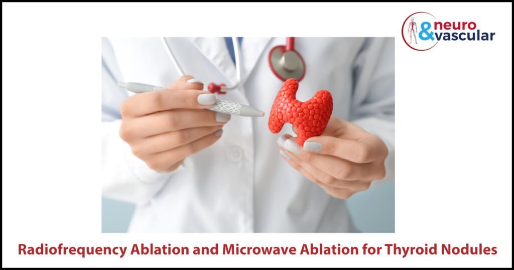Thyroid Nodule Ablation Procedure