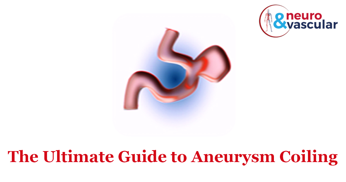 The Ultimate Guide To Aneurysm Coiling Dr Suresh Giragani