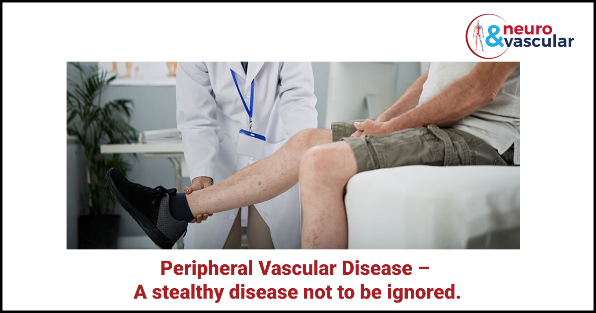 Peripheral Vascular Disease – A Stealthy Disease Not to Be Ignored