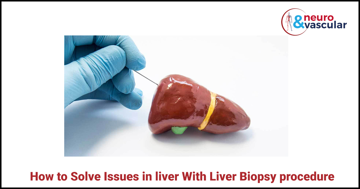 How To Solve Issues in Liver With Liver Biopsy procedure