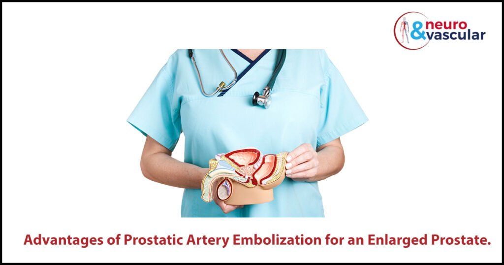 prostatic artery embolization