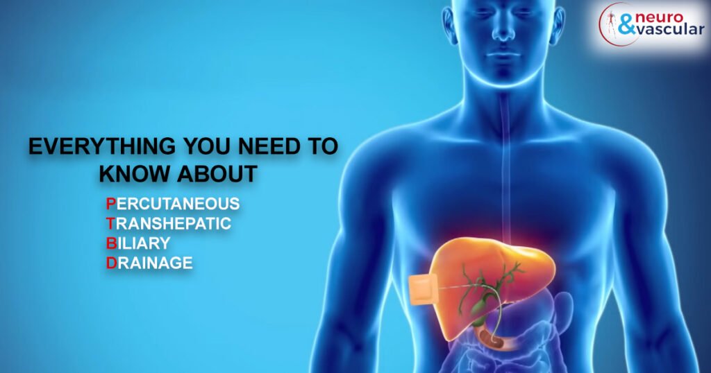 Percutaneous Transhepatic Biliary Drainage(PTBD)