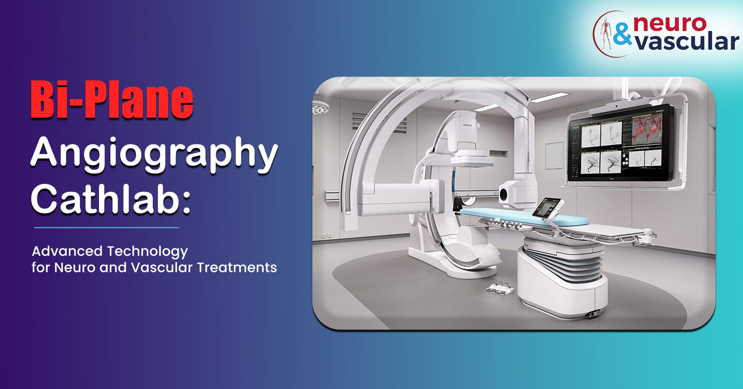 Bi-plane Angiography Cathlab: Advanced Technology for Neuro and Vascular Treatments
