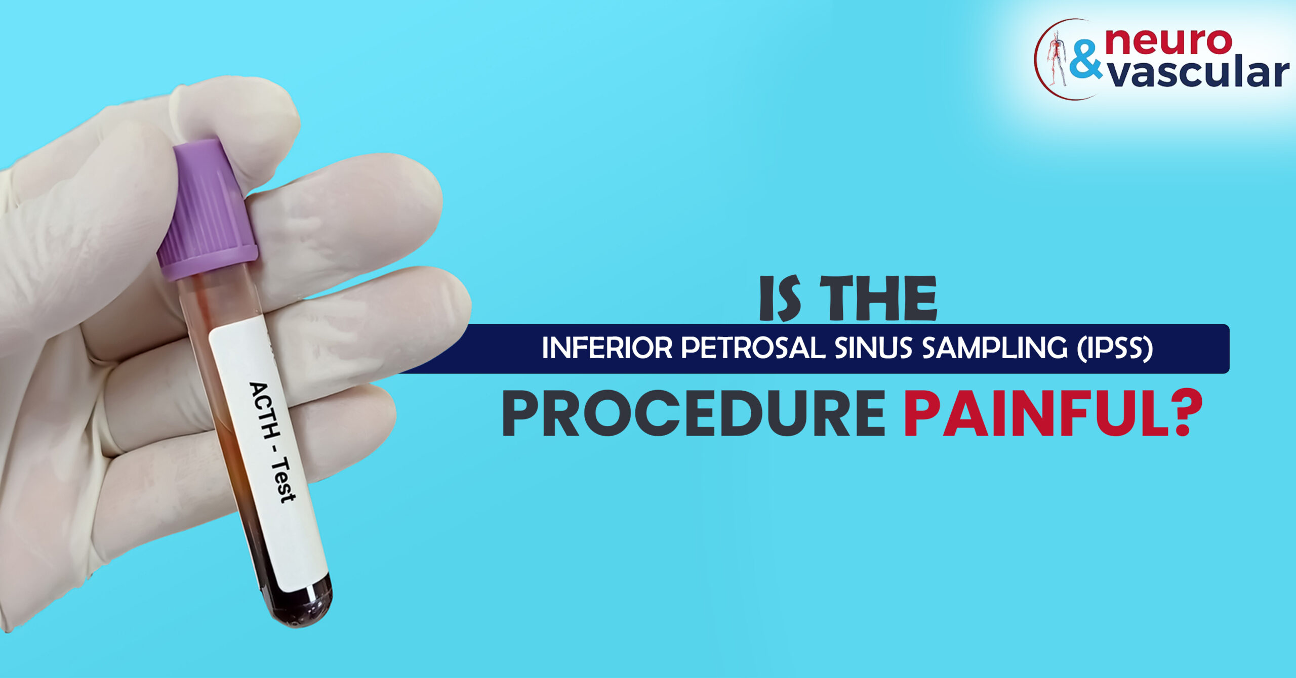 Is the Inferior Petrosal Sinus Sampling (IPSS) procedure Painful?