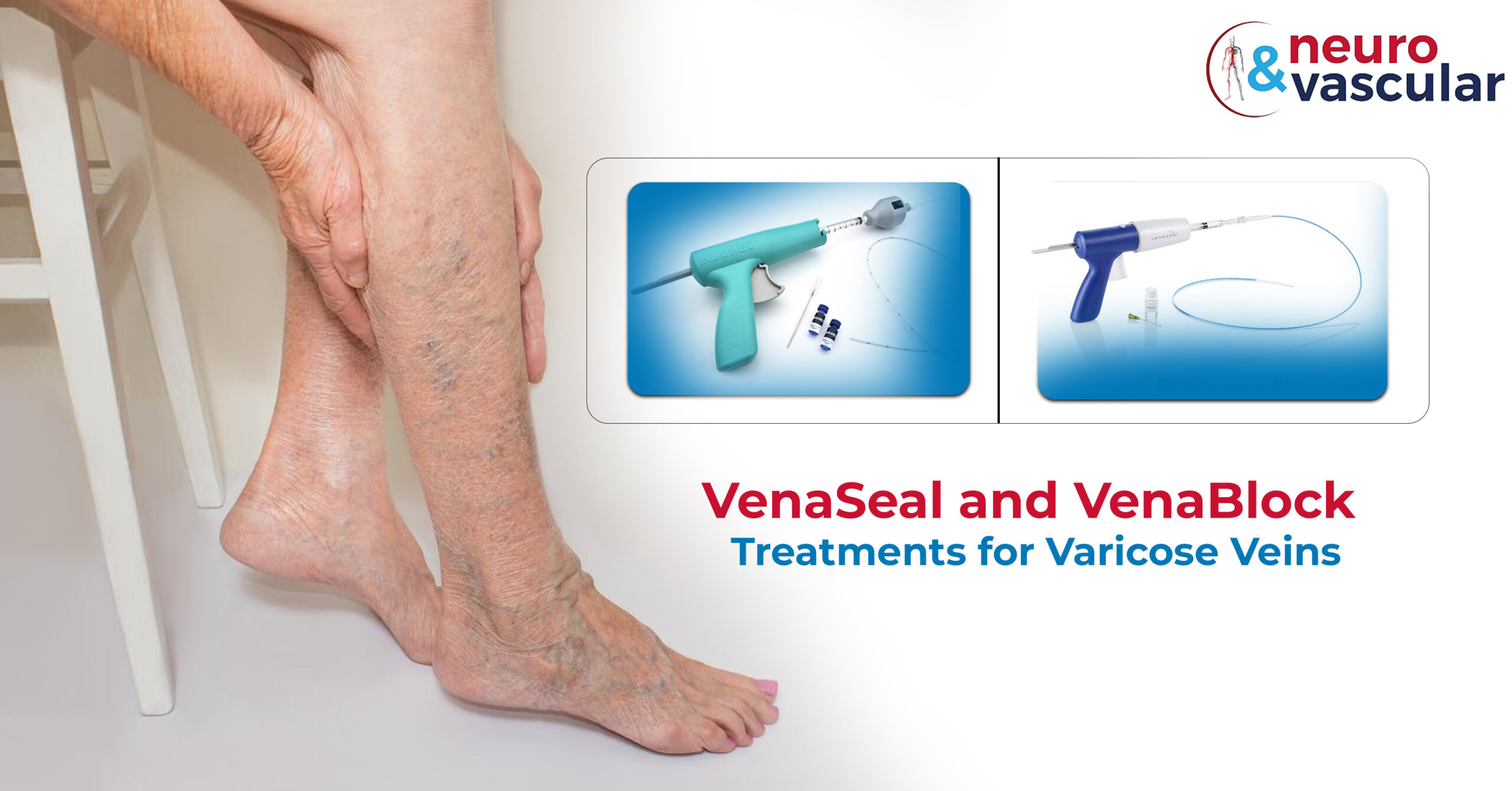 Vena Block & VenaSeal Treatments for Varicose Veins