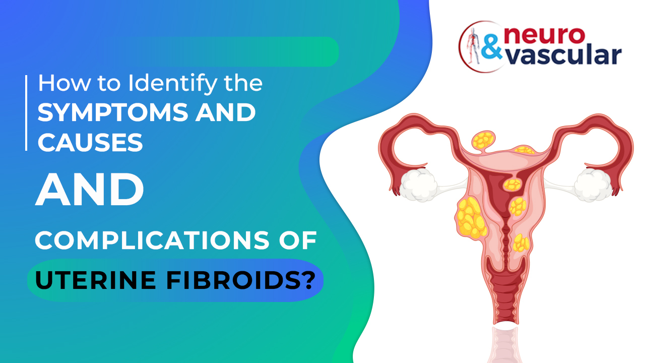 How to Identify the Symptoms and Causes and Complications of Uterine Fibroids?