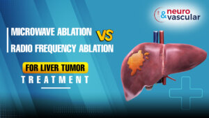 liver cancer treatments in Hyderabad