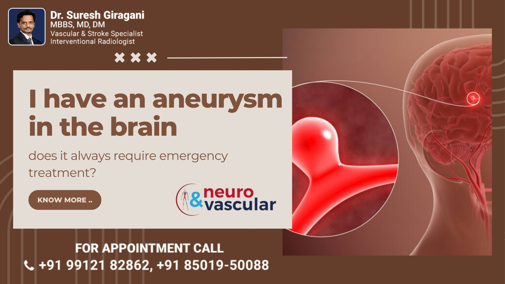 I have an aneurysm in the brain, Does it always require Emergency treatment?