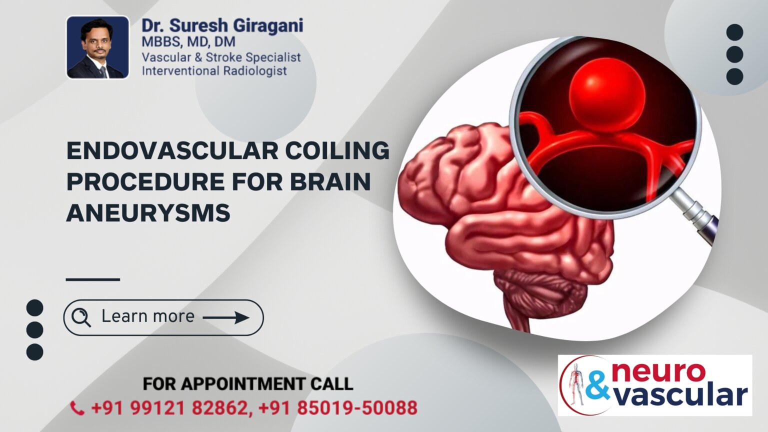 Endovascular Coiling Procedure for Brain Aneurysms