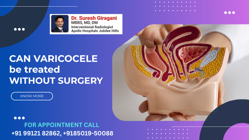 Can Varicocele Be Treated Without Surgery?