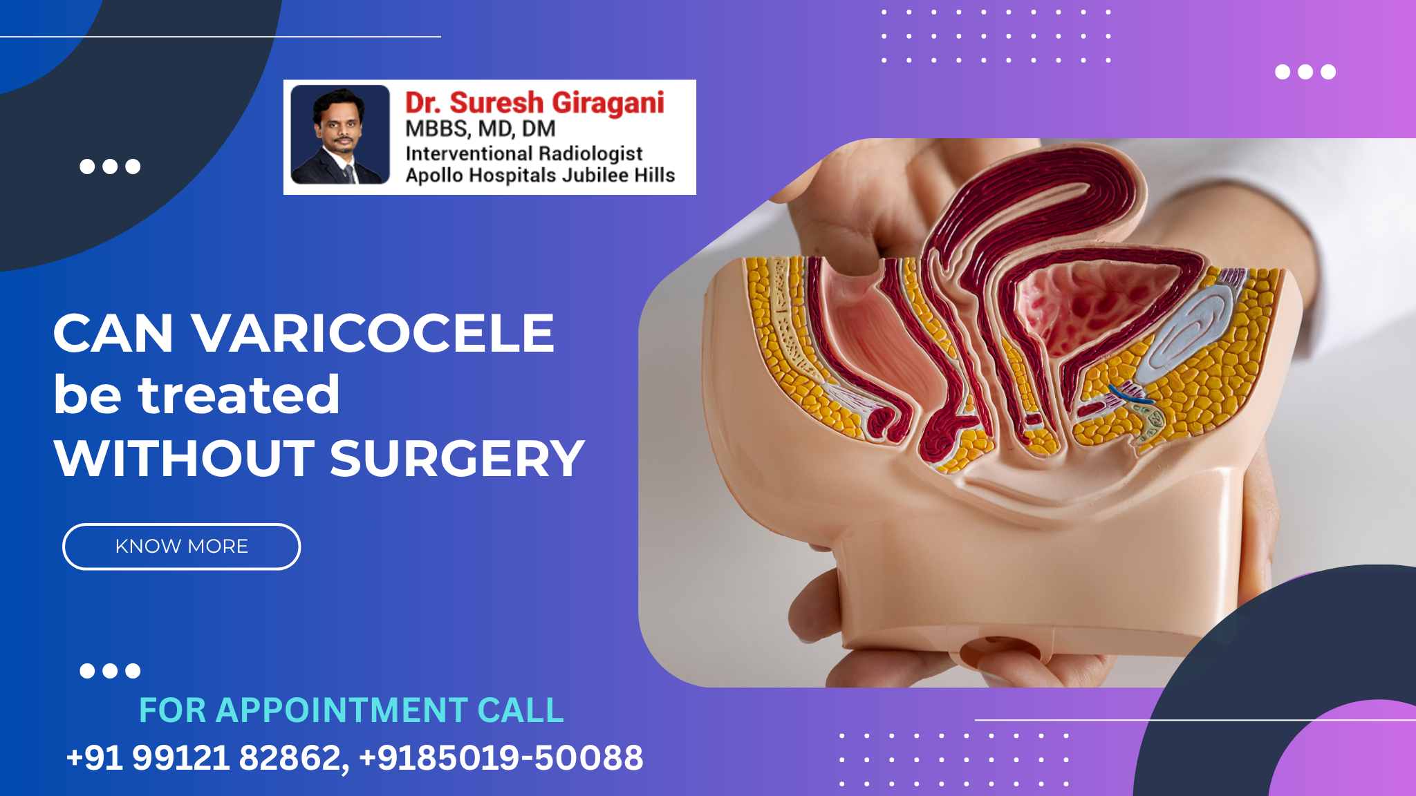 Can Varicocele Be Treated Without Surgery?