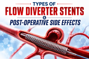 flow diverter stents types