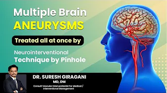 DR. Suresh Giragani | Neurointerventionalist and Vascular Specialist in ...