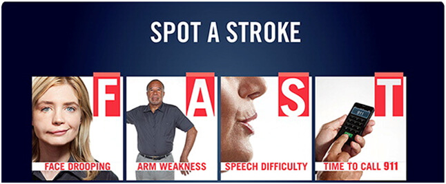 Acute Stroke Treatment in Hyderabad